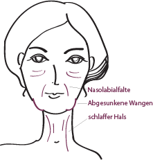 Zonen Facelift in München, Dr. Barbara Kernt 